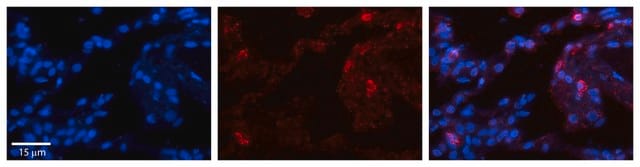 Anti-GPX3 antibody produced in rabbit affinity isolated antibody