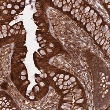 抗-PHLDB3 兔抗 Prestige Antibodies&#174; Powered by Atlas Antibodies, affinity isolated antibody, buffered aqueous glycerol solution