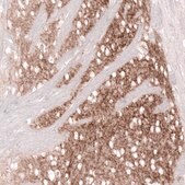 Monoclonal Anti-GPR88 antibody produced in mouse Prestige Antibodies® Powered by Atlas Antibodies, clone CL15190, purified antibody (Protein A)