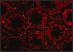 Anti-TEM1 (ab2) antibody produced in rabbit affinity isolated antibody, buffered aqueous solution