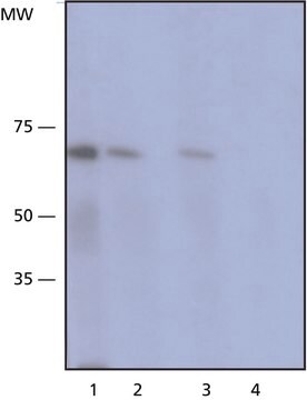 Monoclonal Anti-Tyrosinase 小鼠抗 clone T311, purified immunoglobulin, buffered aqueous solution