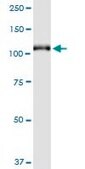 Monoclonal Anti-GRM6 antibody produced in mouse clone 1A11, purified immunoglobulin, buffered aqueous solution