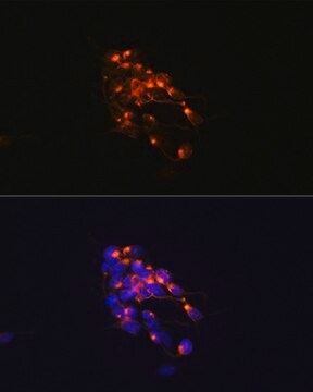 Anti-Neurofilament M Antibody, clone 5E0D2, Rabbit Monoclonal