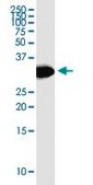 Monoclonal Anti-HSD17B12 antibody produced in mouse clone 4G11, purified immunoglobulin, buffered aqueous solution