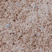 Monoclonal Anti-CNP antibody produced in mouse Prestige Antibodies® Powered by Atlas Antibodies, clone CL2871, purified immunoglobulin, buffered aqueous glycerol solution