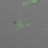 BioTracker™ TAS2 Proteasome Activity Live Cell Probe