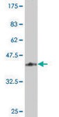 ANTI-TIE1 antibody produced in mouse clone 2C7, purified immunoglobulin, buffered aqueous solution