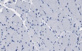 Anti-JPH2 Antibody, clone 1O14 ZooMAb® Rabbit Monoclonal recombinant, expressed in HEK 293 cells