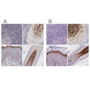 Anti-GSDMA antibody produced in rabbit Prestige Antibodies&#174; Powered by Atlas Antibodies, affinity isolated antibody, buffered aqueous glycerol solution