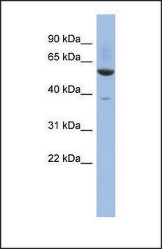 Anti-ZNF783 antibody produced in rabbit affinity isolated antibody