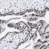 Anti-ZFAT antibody produced in rabbit Prestige Antibodies&#174; Powered by Atlas Antibodies, affinity isolated antibody, buffered aqueous glycerol solution