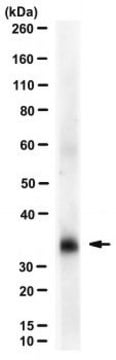 Anti-SARS-CoV RBD Antibody, clone m396