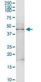 Anti-TRDMT1 antibody produced in rabbit purified immunoglobulin, buffered aqueous solution