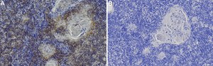 Anti-CD261/DR4 Antibody, clone 1B7 ZooMAb® Rabbit Monoclonal recombinant, expressed in HEK 293 cells