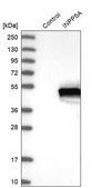 Anti-INPP5A antibody produced in rabbit Prestige Antibodies® Powered by Atlas Antibodies, affinity isolated antibody, buffered aqueous glycerol solution