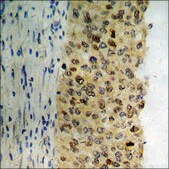 Anti-phospho-ATF2 (pThr71 or 53) antibody produced in rabbit affinity isolated antibody