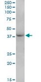 Anti-FBXO28 antibody produced in mouse purified immunoglobulin, buffered aqueous solution