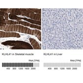 Anti-KLHL41 antibody produced in rabbit Prestige Antibodies® Powered by Atlas Antibodies, affinity isolated antibody, buffered aqueous glycerol solution, Ab1