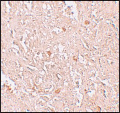 Anti-FBXL16 antibody produced in rabbit affinity isolated antibody, buffered aqueous solution