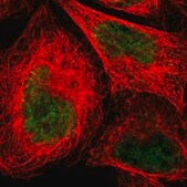 抗-NMI 兔抗 Prestige Antibodies&#174; Powered by Atlas Antibodies, affinity isolated antibody, buffered aqueous glycerol solution