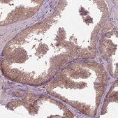 Anti-NT5DC2 antibody produced in rabbit Prestige Antibodies&#174; Powered by Atlas Antibodies, affinity isolated antibody, buffered aqueous glycerol solution