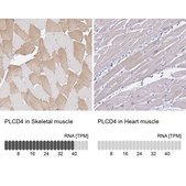 Anti-PLCD4 antibody produced in rabbit Prestige Antibodies® Powered by Atlas Antibodies, affinity isolated antibody, buffered aqueous glycerol solution
