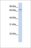 Anti-MAK antibody produced in rabbit affinity isolated antibody