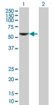 Anti-ALDH6A1 antibody produced in mouse IgG fraction of antiserum, buffered aqueous solution