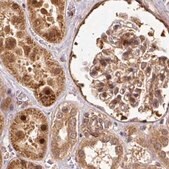 Anti-PSMD1 antibody produced in rabbit Prestige Antibodies&#174; Powered by Atlas Antibodies, affinity isolated antibody, buffered aqueous glycerol solution