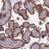 Anti-FAM126A antibody produced in rabbit Prestige Antibodies&#174; Powered by Atlas Antibodies, affinity isolated antibody, buffered aqueous glycerol solution
