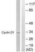 Anti-CYCLIN D1, C-Terminal antibody produced in rabbit affinity isolated antibody