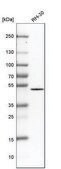 Anti-OTUD3 antibody produced in rabbit Prestige Antibodies® Powered by Atlas Antibodies, affinity isolated antibody, buffered aqueous glycerol solution
