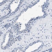 Anti-NUDT5 antibody produced in rabbit Prestige Antibodies&#174; Powered by Atlas Antibodies, affinity isolated antibody, buffered aqueous glycerol solution