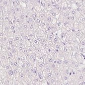 Monoclonal Anti-SIX1 antibody produced in mouse Prestige Antibodies&#174; Powered by Atlas Antibodies, clone CL0185, purified immunoglobulin, buffered aqueous glycerol solution