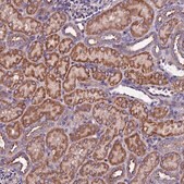 Anti-CLN5 antibody produced in rabbit Prestige Antibodies&#174; Powered by Atlas Antibodies, affinity isolated antibody, buffered aqueous glycerol solution