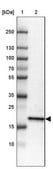 Anti-ZNF22 antibody produced in rabbit Prestige Antibodies&#174; Powered by Atlas Antibodies, affinity isolated antibody, buffered aqueous glycerol solution