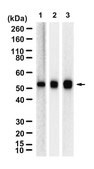 Anti-CaM Kinase II β Antibody, clone 1F13 ZooMAb® Rabbit Monoclonal recombinant, expressed in HEK 293 cells