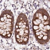 Anti-ST13 antibody produced in rabbit Prestige Antibodies&#174; Powered by Atlas Antibodies, affinity isolated antibody, buffered aqueous glycerol solution