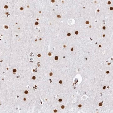 Anti-DHX9 antibody produced in rabbit Prestige Antibodies&#174; Powered by Atlas Antibodies, affinity isolated antibody, buffered aqueous glycerol solution