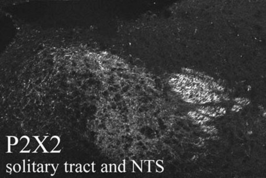 Anti-P2X2 Receptor Antibody serum, Chemicon&#174;