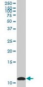 Anti-S100A10 antibody produced in mouse purified immunoglobulin, buffered aqueous solution
