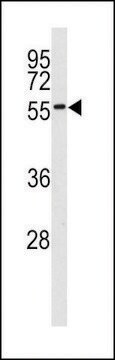 ANTI-MNK2 (MKNK2)(C-TERMINAL) antibody produced in rabbit IgG fraction of antiserum, buffered aqueous solution