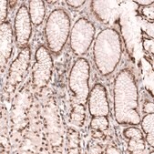 Anti-NUP54 antibody produced in rabbit Prestige Antibodies&#174; Powered by Atlas Antibodies, affinity isolated antibody, buffered aqueous glycerol solution