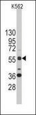 Anti-SHB (center) antibody produced in rabbit saturated ammonium sulfate (SAS) precipitated, buffered aqueous solution
