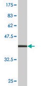 Monoclonal Anti-DOT1L antibody produced in mouse clone 8B2, purified immunoglobulin, buffered aqueous solution
