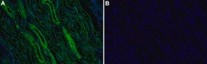 Anti-BRCC3 Antibody, clone 2M19 ZooMAb&#174; Rabbit Monoclonal recombinant, expressed in HEK 293 cells