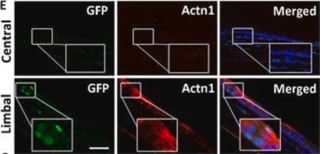 Anti-ACTN1 antibody produced in rabbit Prestige Antibodies&#174; Powered by Atlas Antibodies, affinity isolated antibody, buffered aqueous glycerol solution