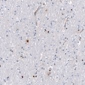 Monoclonal Anti-SERPINA3 antibody produced in mouse Prestige Antibodies® Powered by Atlas Antibodies, clone CL10697, purified antibody (Protein A)