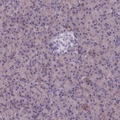 Anti-SPTLC3 antibody produced in rabbit Prestige Antibodies&#174; Powered by Atlas Antibodies, affinity isolated antibody, buffered aqueous glycerol solution
