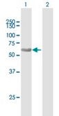 Anti-SQSTM1 antibody produced in mouse purified immunoglobulin, buffered aqueous solution